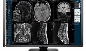 ImageVision